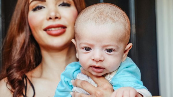 Rhinoplastie avant après : résultats impressionnants et rapides